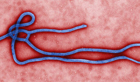 Ebola Virus Disease
