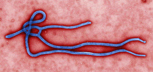 How To Avoid Ebola Virus Disease Symptoms and Risks