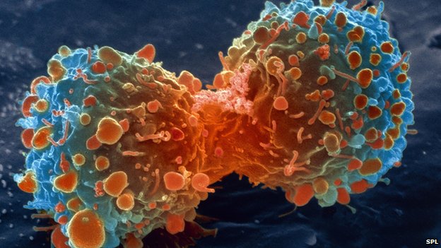 Cancer is Pure Strike of Bad Luck Studies Suggest