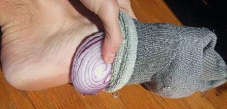 Benefits of Placing a Slice of Onion in Your Feet