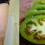 How to Treat and Cure Varicose Veins with Tomatoes