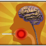 Cigarette Smokers Are Linked to Develop Schizophrenia