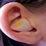 Put an Onion in Your Ear Overnight and Cure Earache