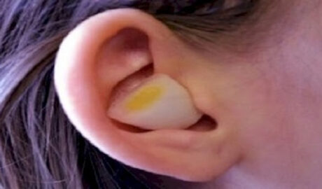 Put an Onion in Your Ear Overnight and Cure Earache