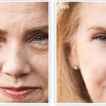 Regain Wrinkles Free Youthful Skin Back with HGH Releasers