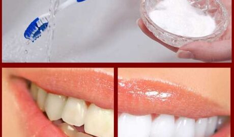 How to Whiten Teeth at Home with Baking Soda