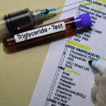 How Can I Lower My Triglycerides?